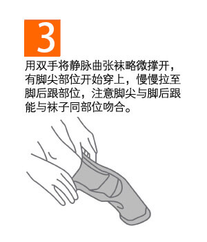 治疗型静脉曲张袜