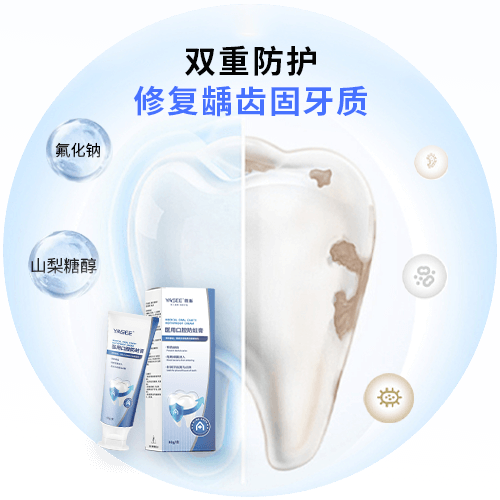 医用口腔防蛀膏d4